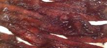 caramelized bacon